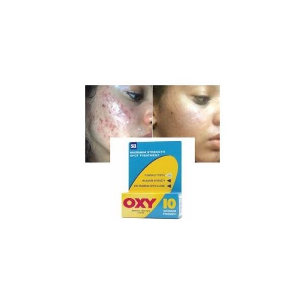 Oxy Maximum Strength Rapid Spot Treatment, 10% Benzoyl Peroxide Acne Treatment - Image 3